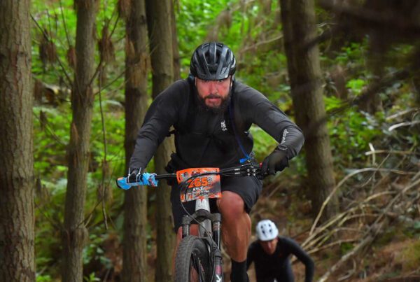 Kyle, upper arm amputee