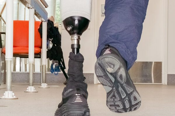 prosthetic leg