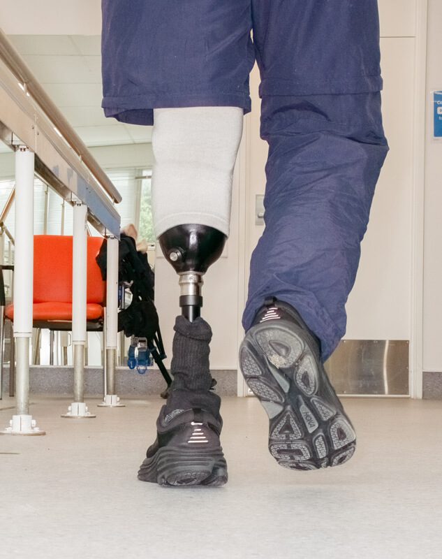 prosthetic limbs, artificial limbs