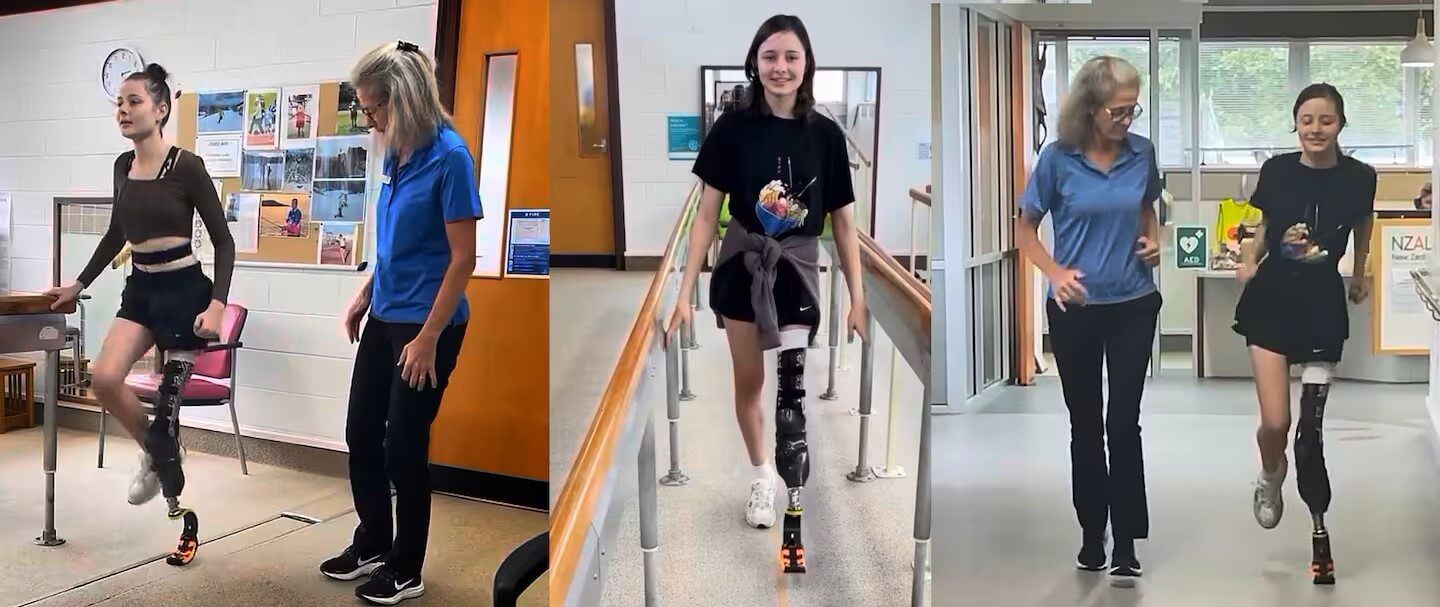 A clinicians view on prostheses for children