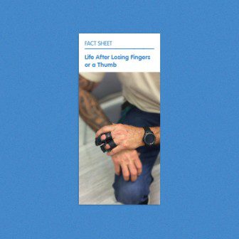 Life after losing fingers or a thumb