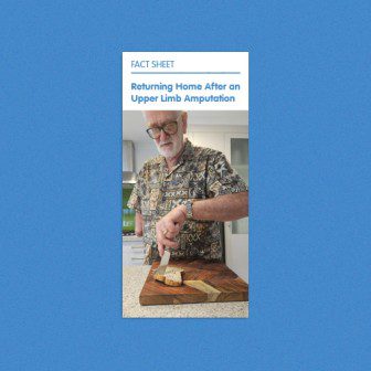 Returning home after an upper limb amputation