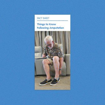 Things to know following amputation