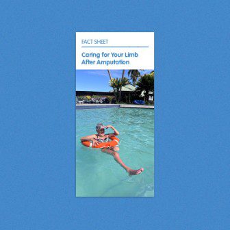 Caring for your limb after amputation