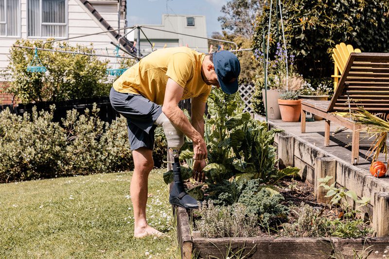 artificial limb in daily life