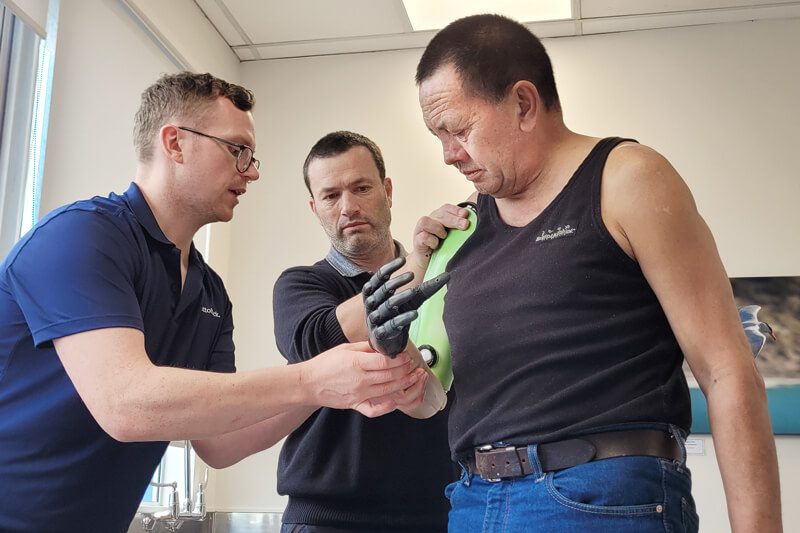 upper limb prosthetic