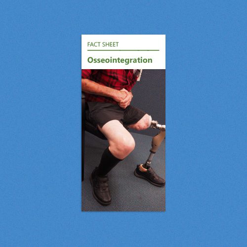 Osseointegration
