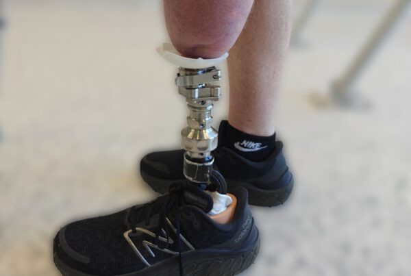 osseointegration procedure